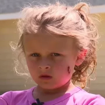 Una niña de seis años fue baleada en la cara por entrar al patio de su vecino a buscar una pelota